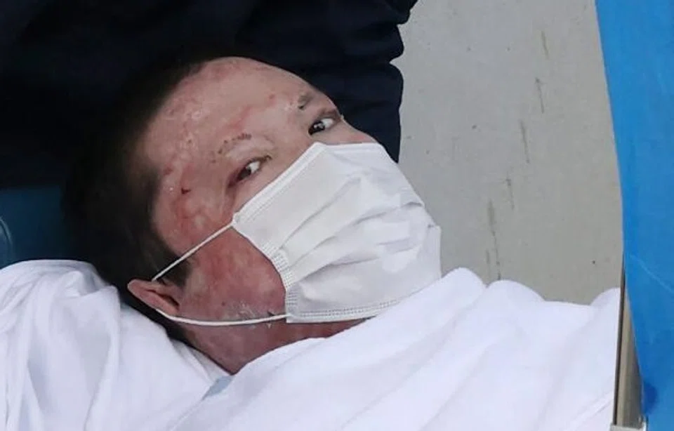 Shinji Aoba, who nearly died from burns he himself sustained, faces five charges including murder, attempted murder and arson, according to local prosecutors.