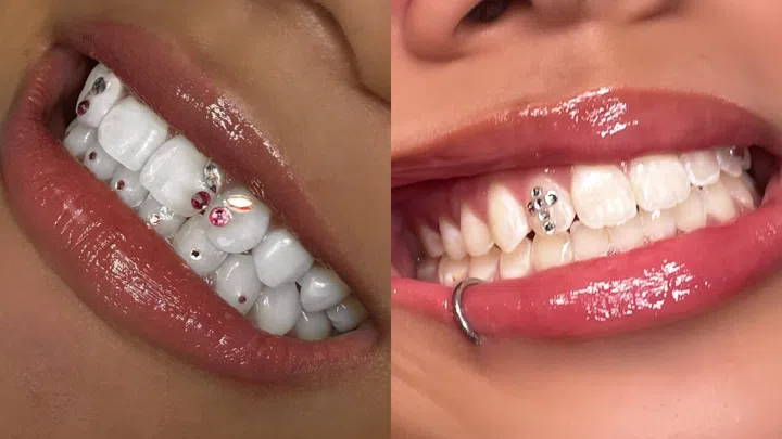 Best Tooth Gem Studios Singapore - IcedByNeko
