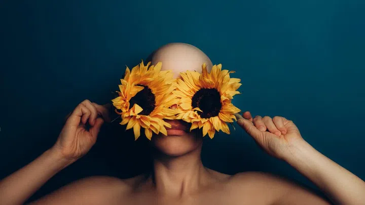 Consider this your 101 alopecia areata. Credit: Envato Elements