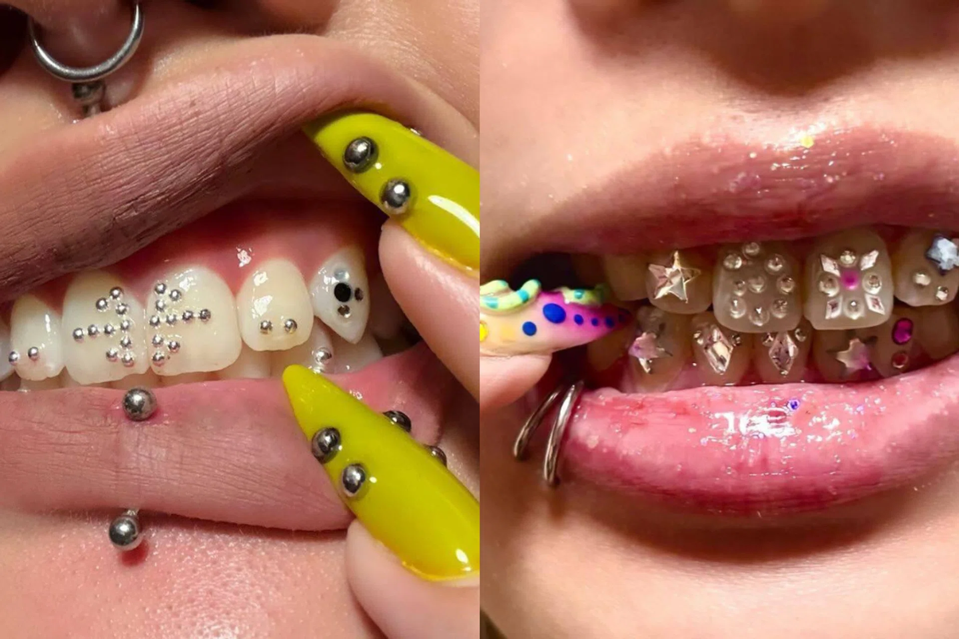 Best Tooth Gem Studios Singapore