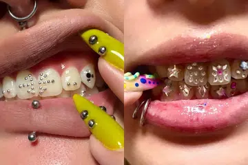 Best Tooth Gem Studios Singapore