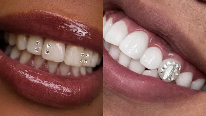 Best Tooth Gem Studios Singapore - Tooth Gem SG