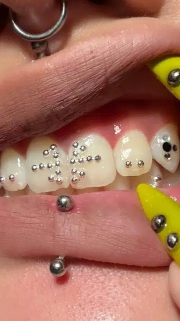 Best Tooth Gem Studios Singapore