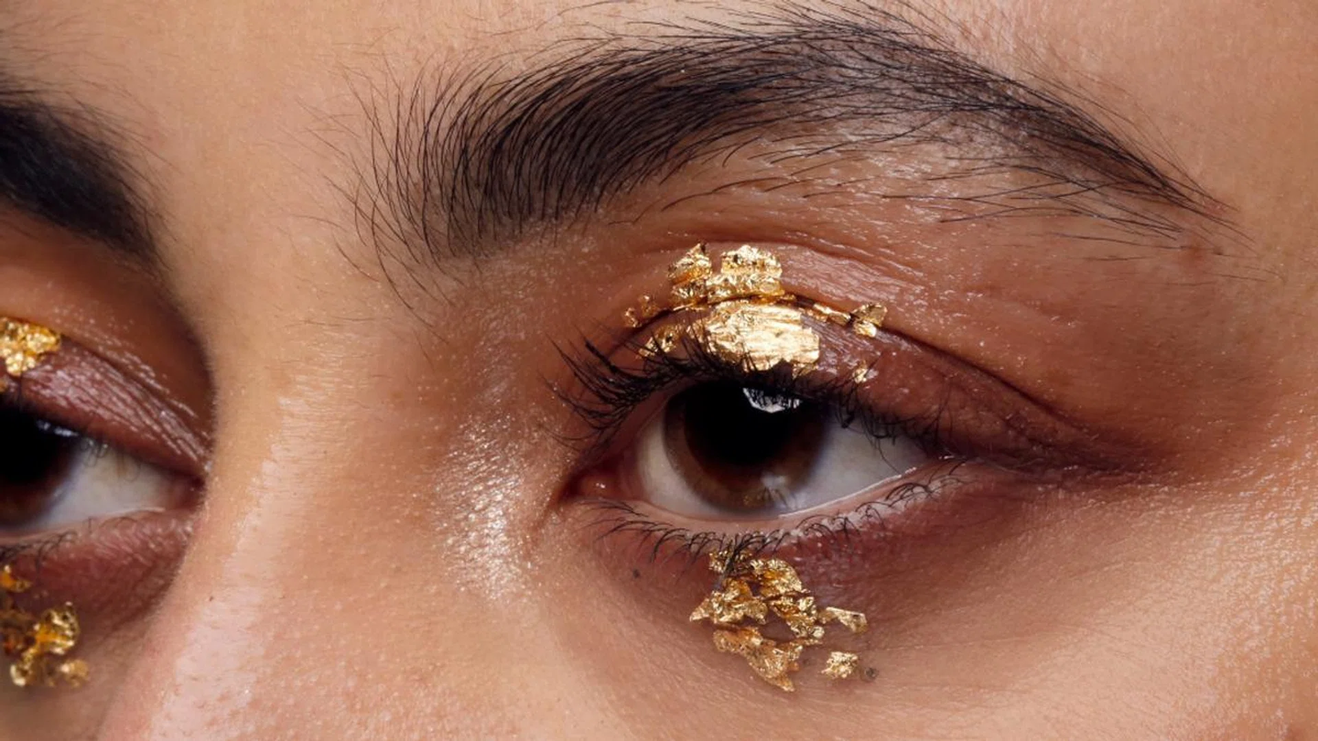 dark eye circles