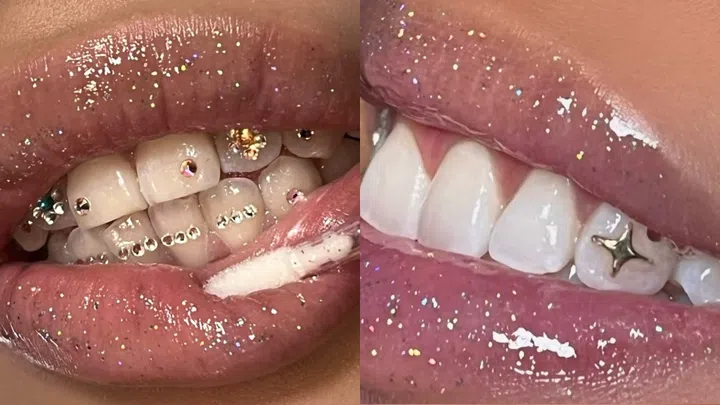Best Tooth Gem Studios Singapore - Toothy Frutti