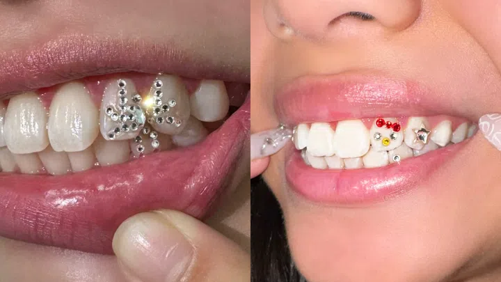 Best Tooth Gem Studios Singapore - Pixie Tooth Gem