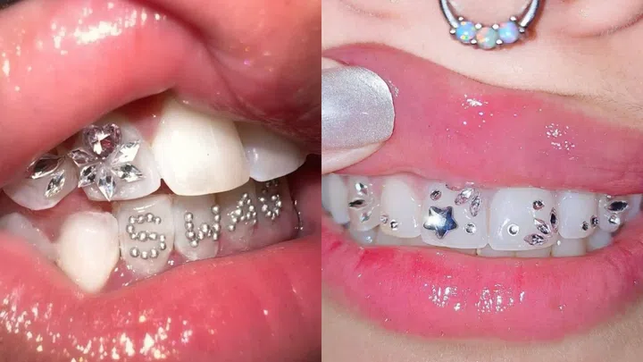Best Tooth Gem Studios Singapore - Tooth Candy