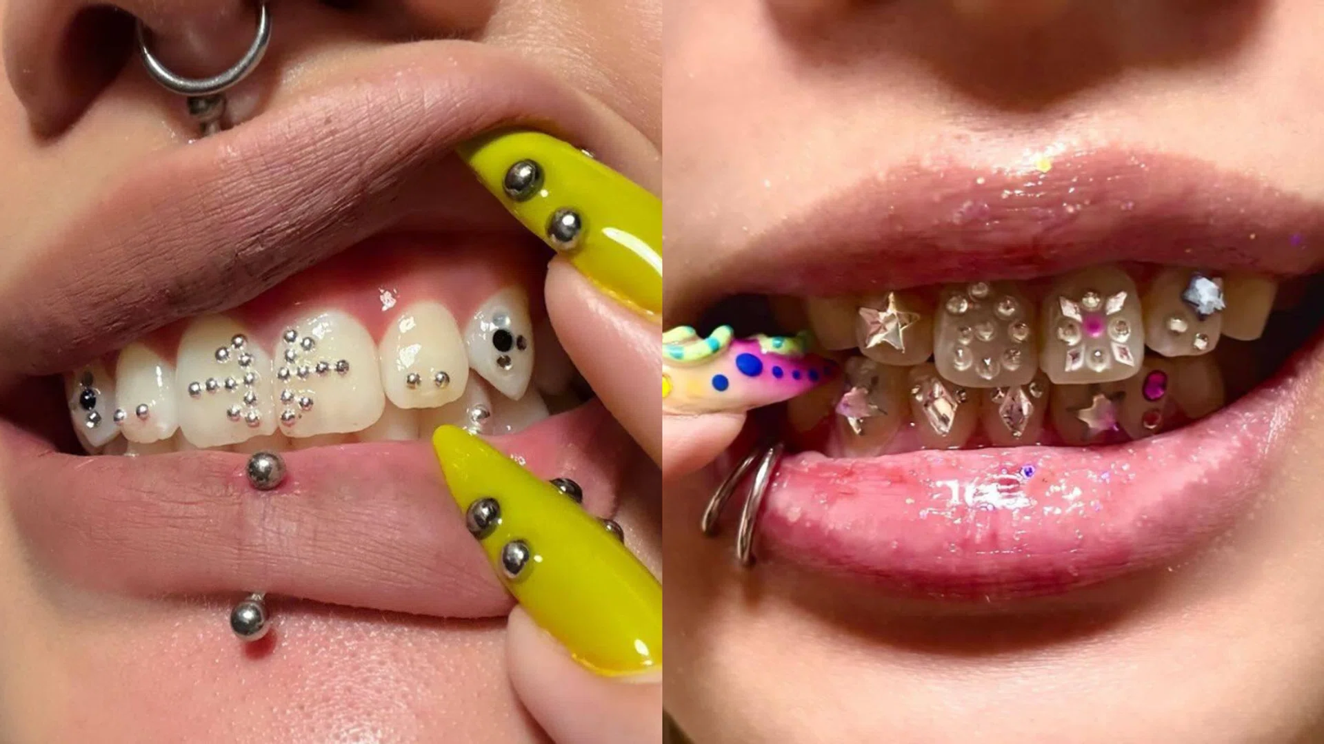 Best Tooth Gem Studios Singapore