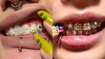 Best Tooth Gem Studios Singapore
