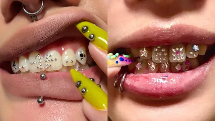 Best Tooth Gem Studios Singapore - Mouldy Molars