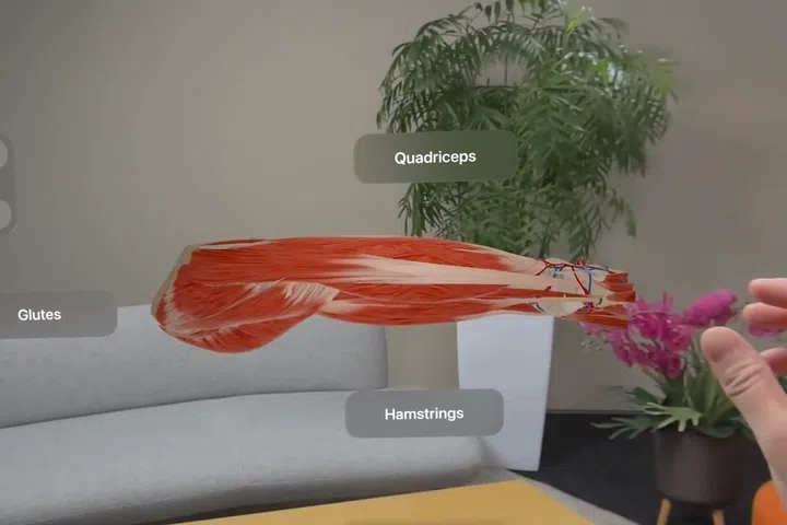 MediView demo