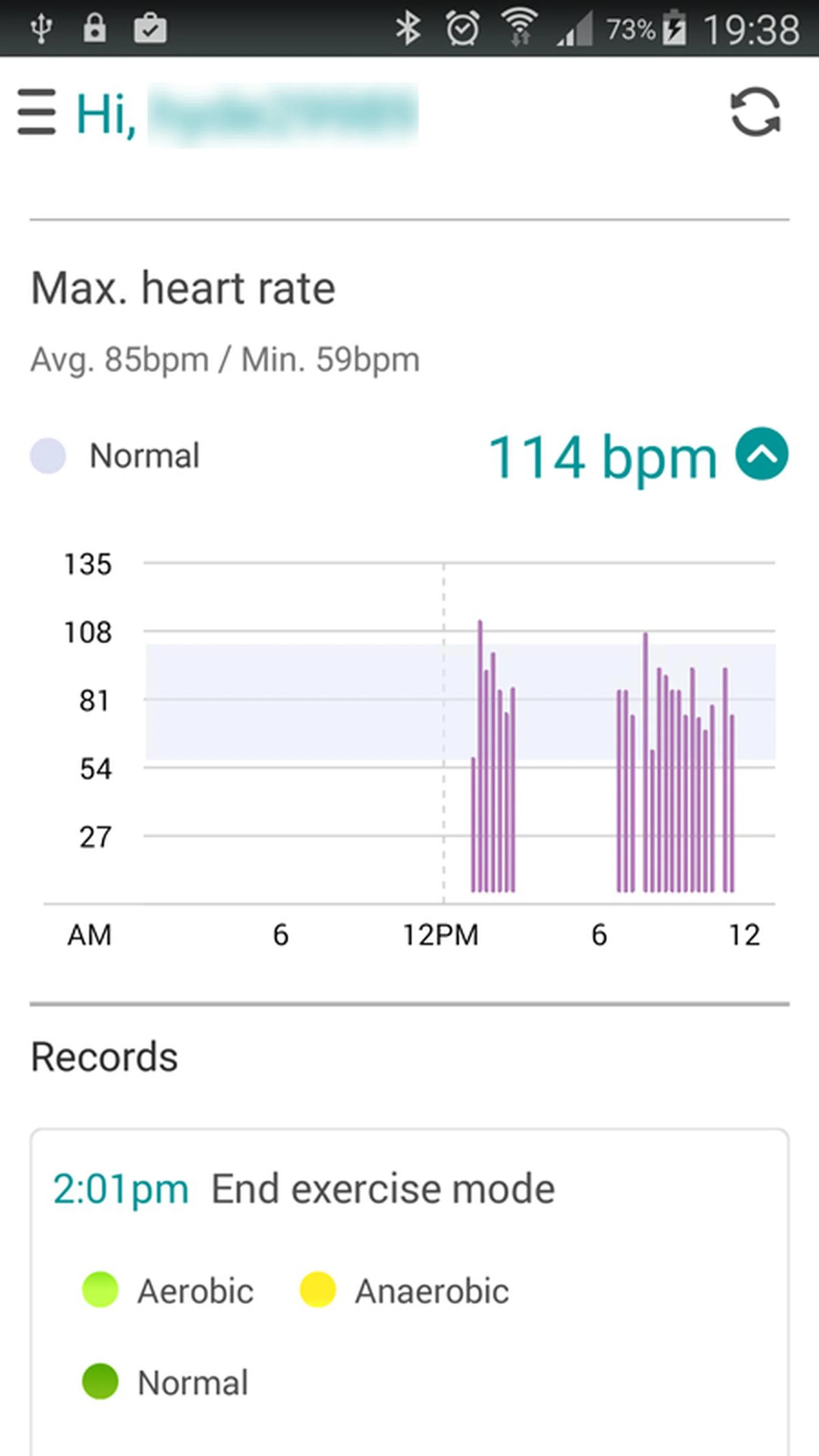 There's no need to wear a chest strap heart rate sensor with the VivoWatch.