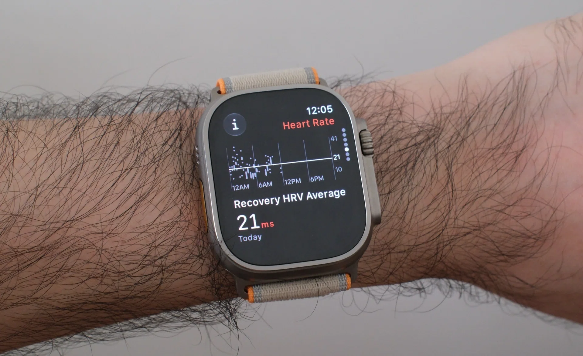 Apple Watch Ultra 4 Recovery HRV
