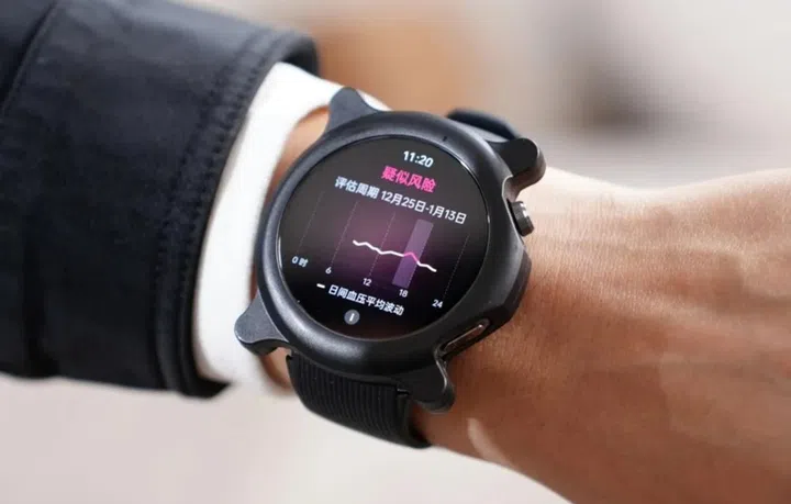 This is probably the first live hands-on photo of the OPPO Watch X2. Photo: Zhou Yibao (Weibo)