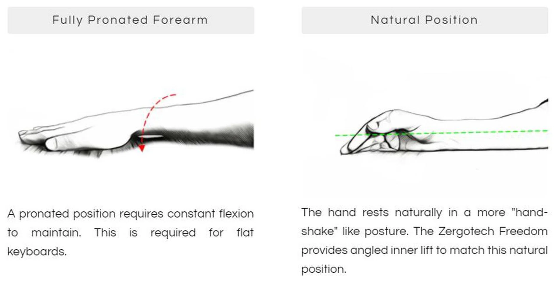 Your wrist and forearm prefer to sit at an angle instead of completely flat. (Image Source: Zergotech)