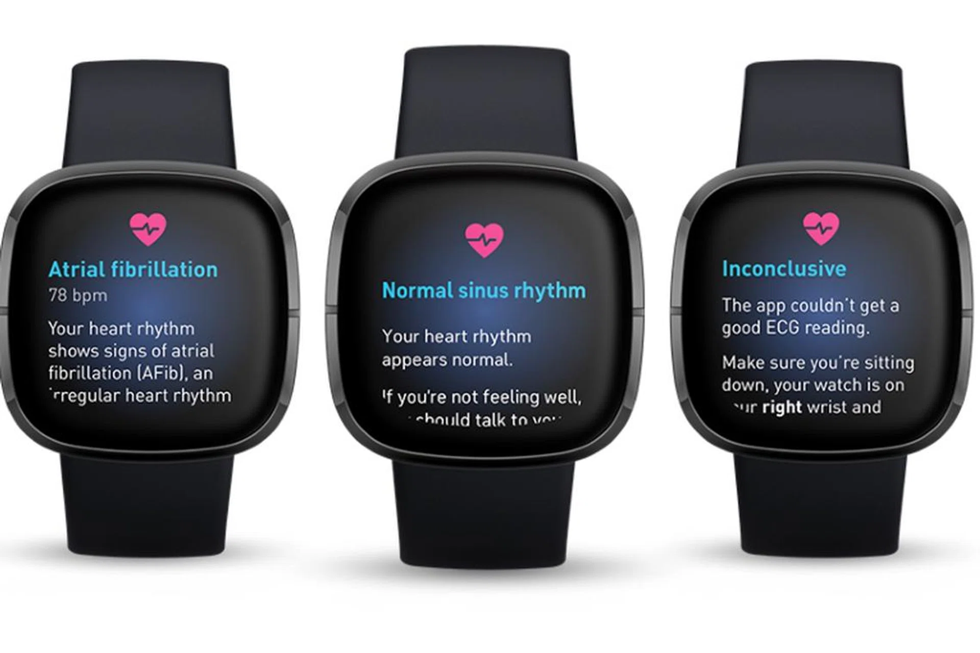 (Image source: Fitbit)