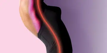 Stretch Marks