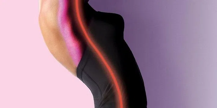 Stretch Marks