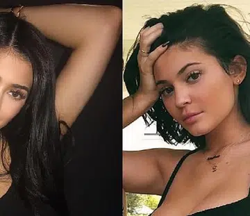 Kylie Jenner reveals on Instagram that she has removed all of her lip fillers
