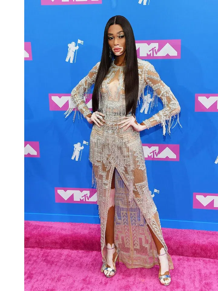 Photo: Getty