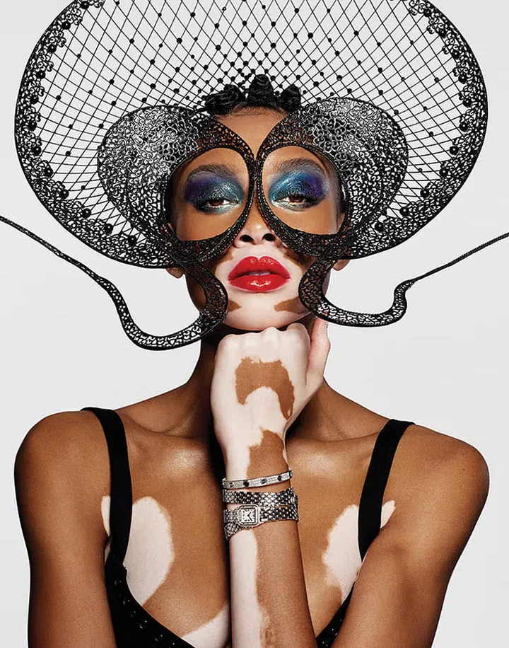 Winnie Harlow