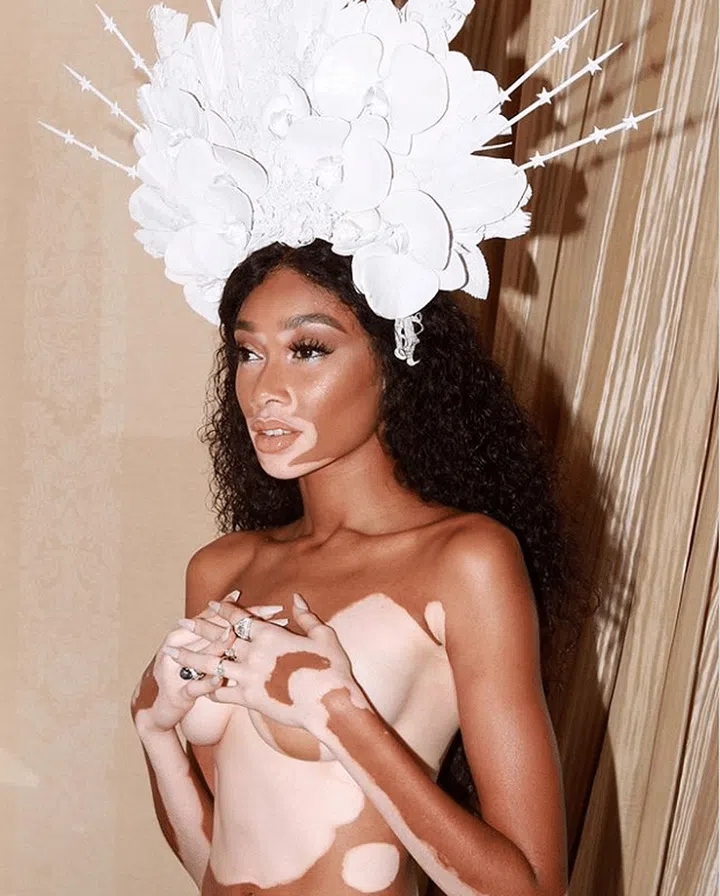 Photo: instagram/@winnieharlow