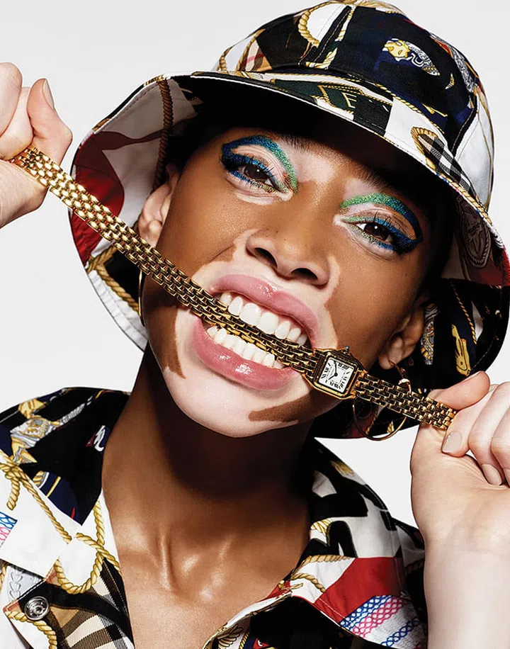 Winnie Harlow