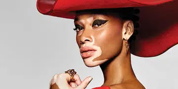winnie harlow