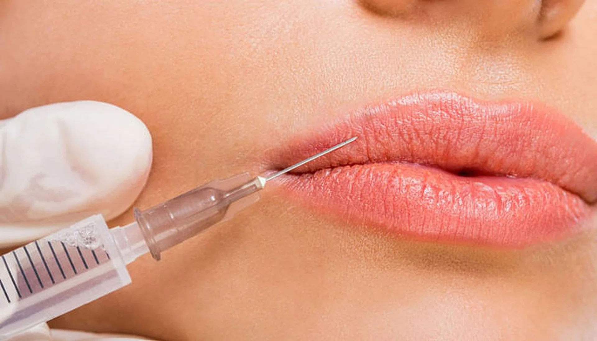 fillers