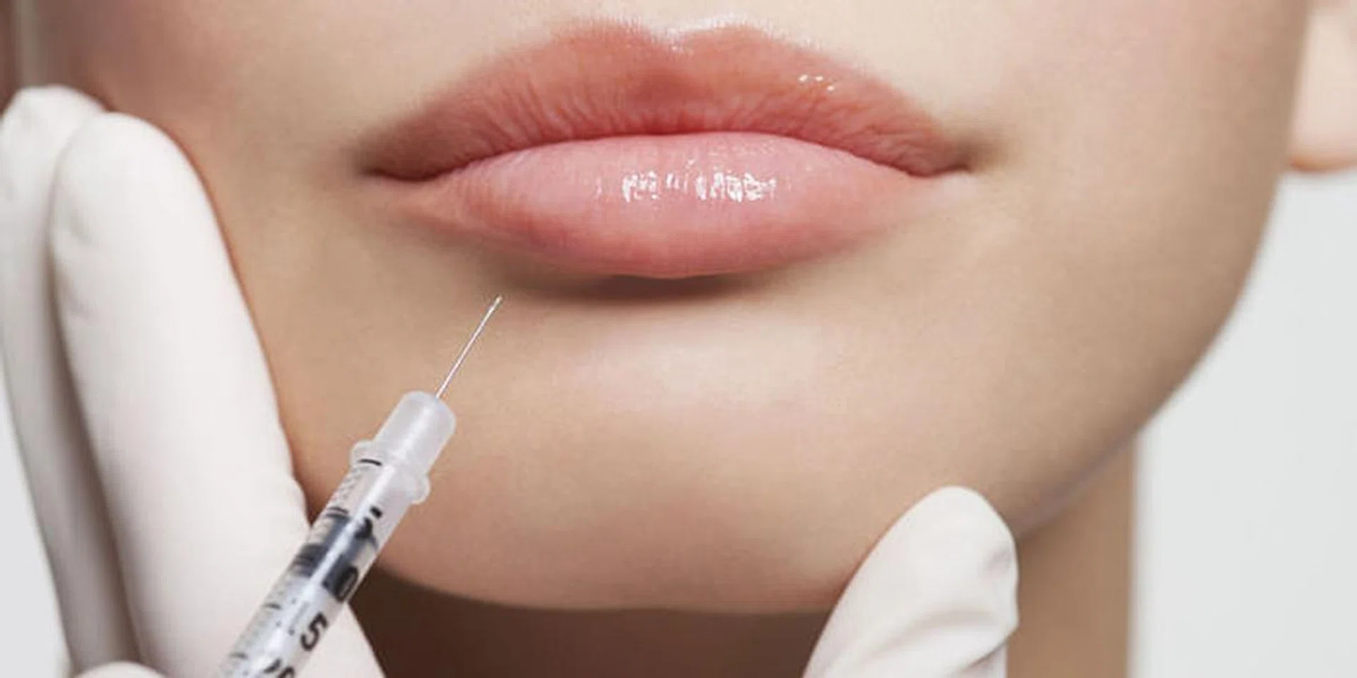 6 Surprising Places You Can Get Botox