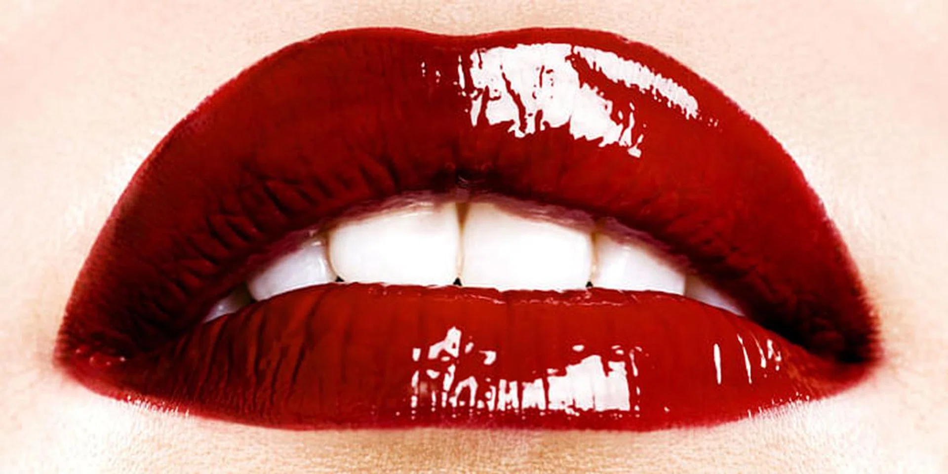 Whiter Teeth