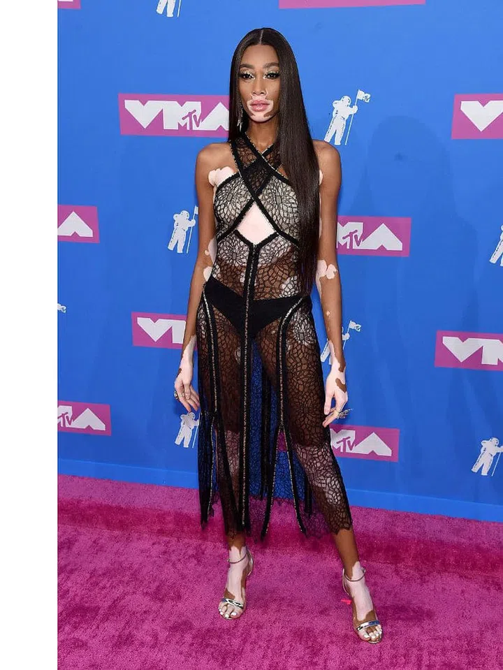 Photo: Getty