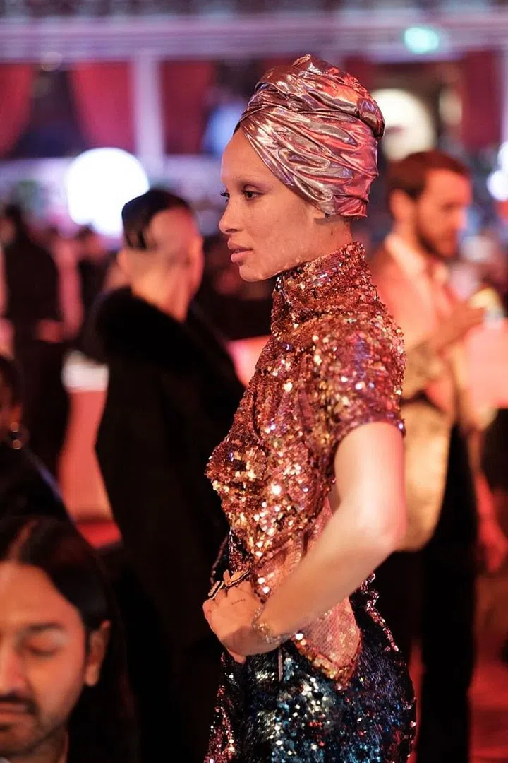Photo: Getty 