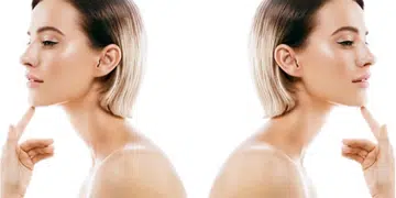 Ultherapy Singapore Cutis Medical Aesthetics Beauty Clinic Skincare Tightening Lifting Treatment Sylvia Ramirez