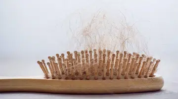 Hair loss