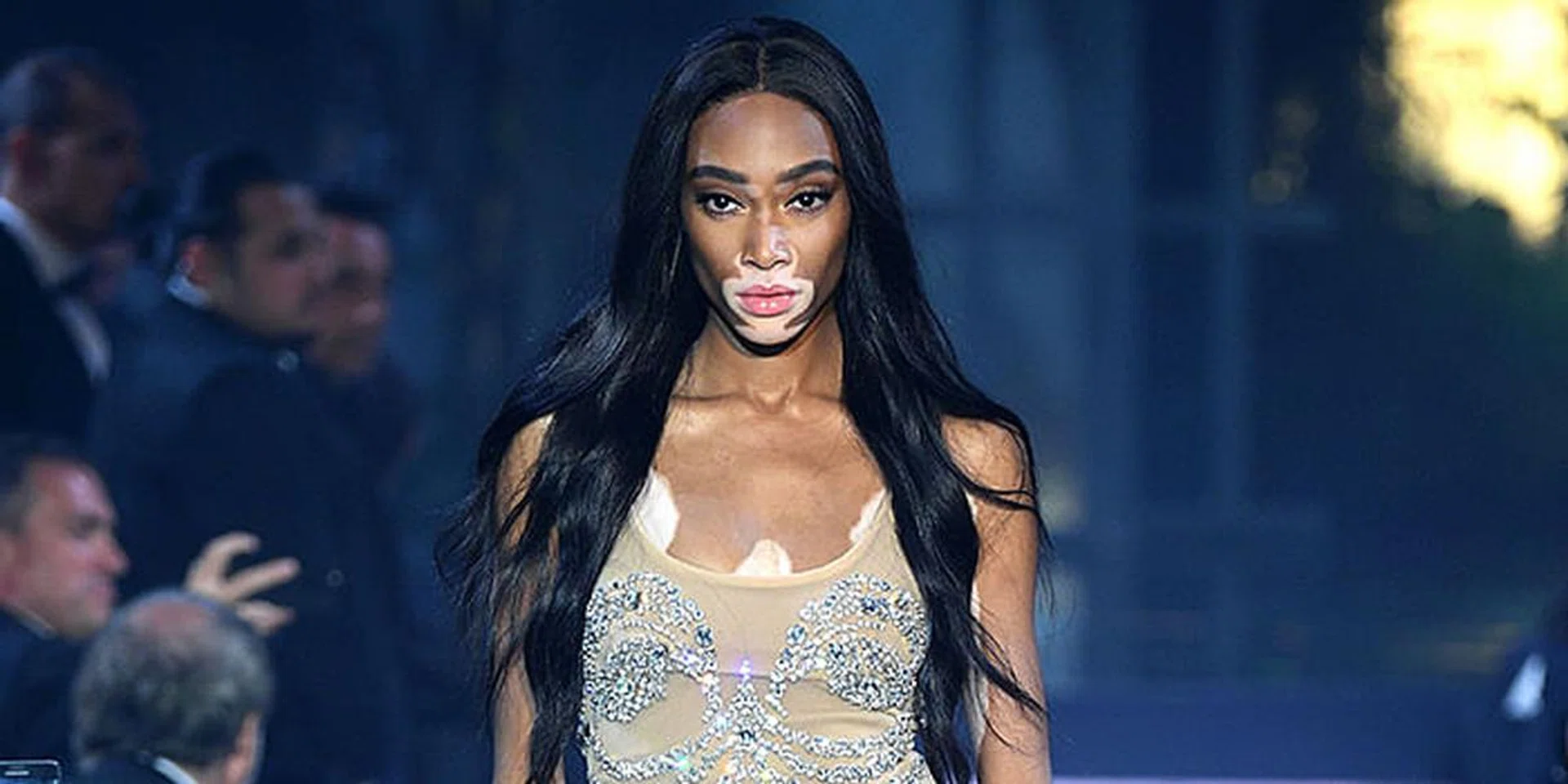 winnie harlow