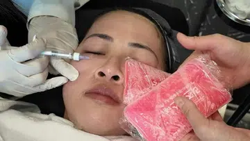 Ms Caitlin Lim getting fillers injected in her under-eye area at an aesthetic clinic.