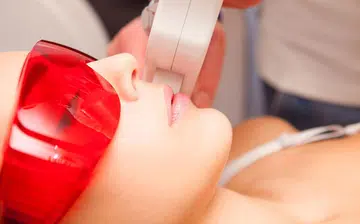 What to know about facial lasers
