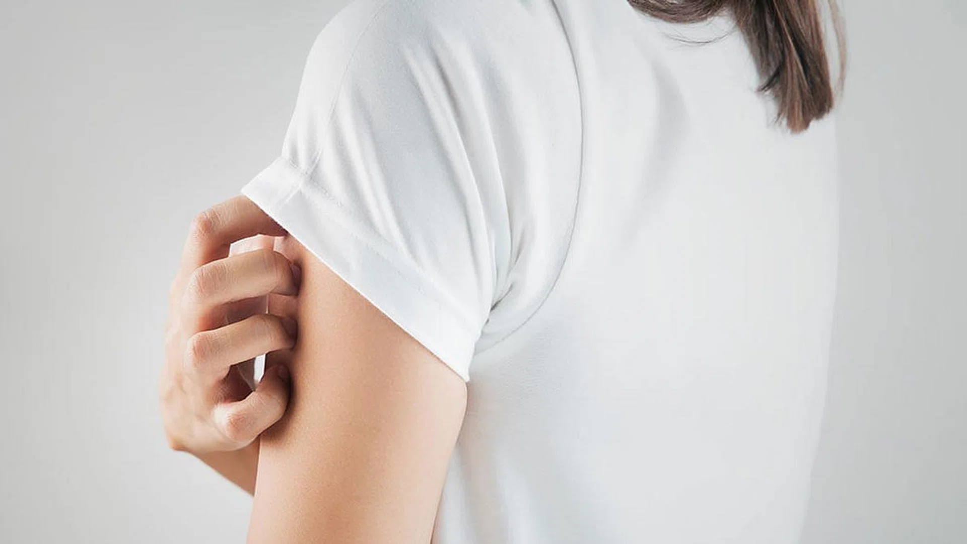 Everything you need to know about psoriasis