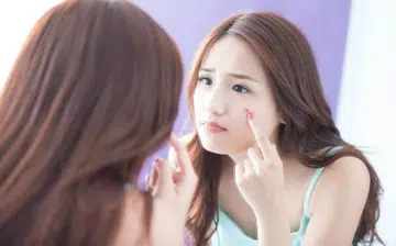 doc_talk_acne_scars_and_how_to_treat_them_900px