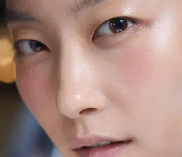 Why you still have zits and pimples in your 20s and older
