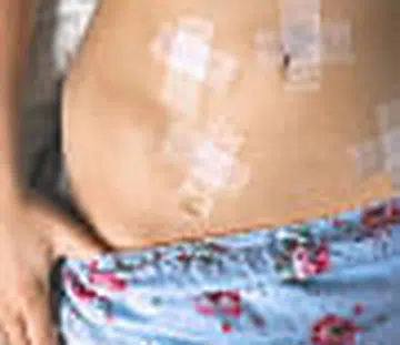 Cervical cancer can be cured if detected early THUMBNAIL