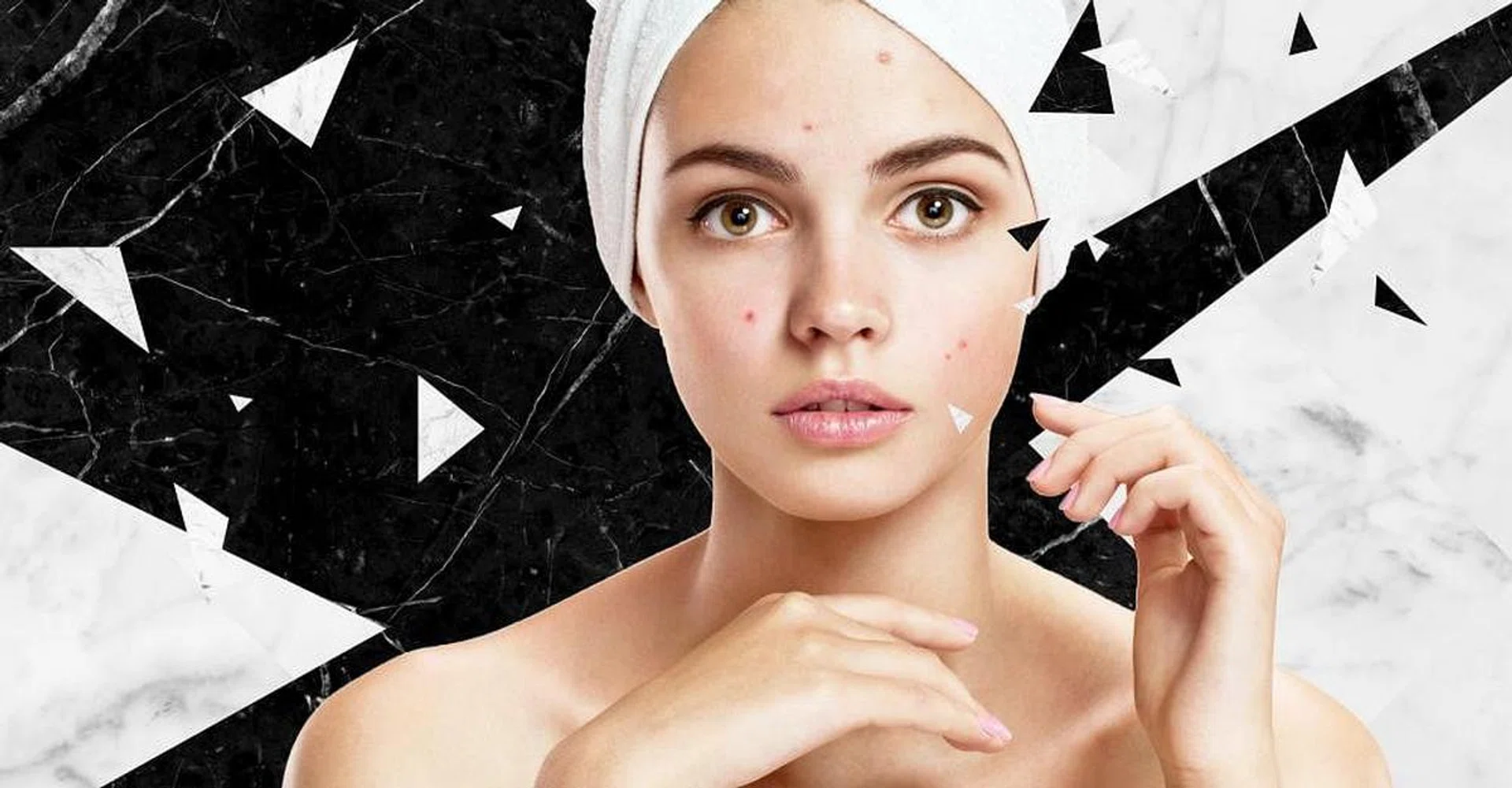 accutane_acne_900x560