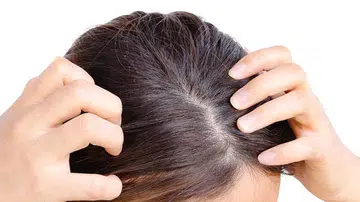Is the hot weather giving you dandruff and sweaty, itchy, and irritated scalp? Here are 8 of the highest rated dandruff shampoos to try out