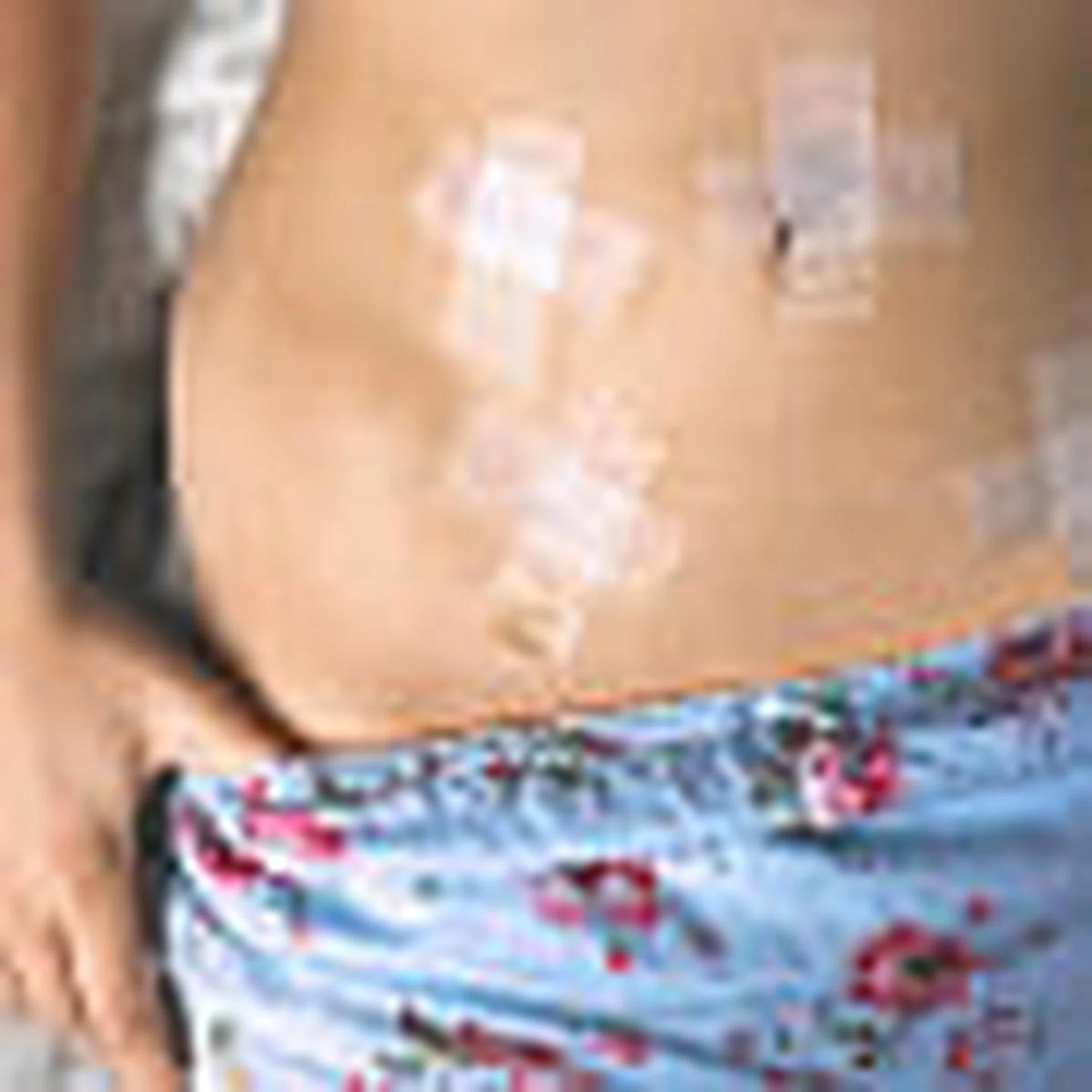 Cervical cancer can be cured if detected early THUMBNAIL