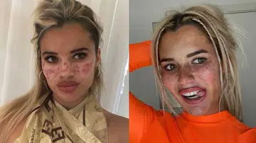 tiktoker tikky whitfeld freckles