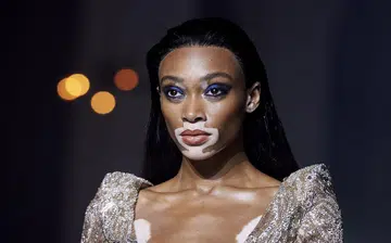 winnieharlow_rect