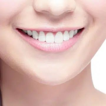 white_smile