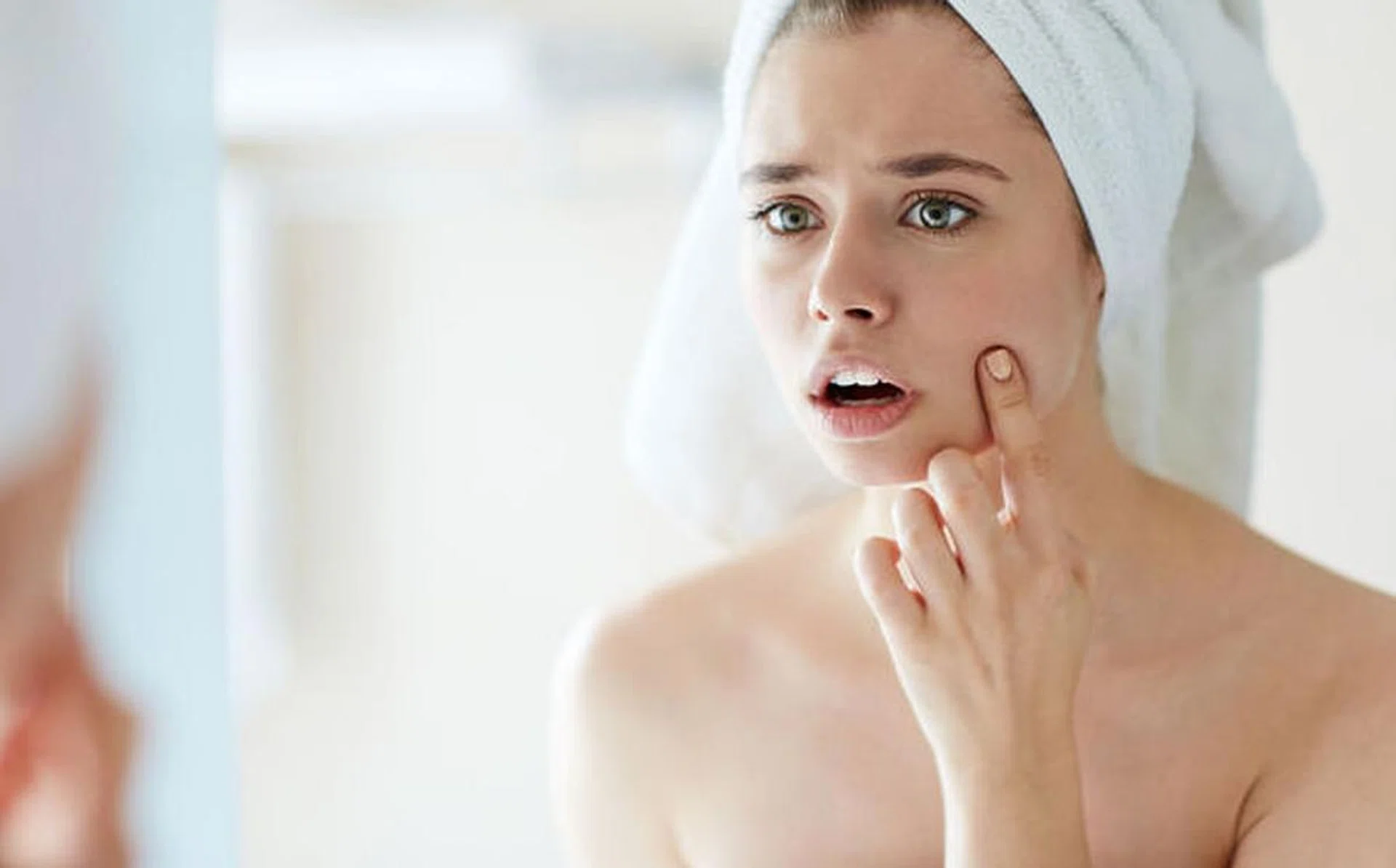 acne_treatments_singapore