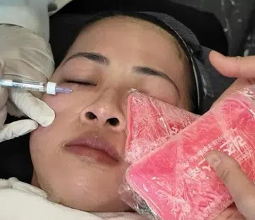 Ms Caitlin Lim getting fillers injected in her under-eye area at an aesthetic clinic.